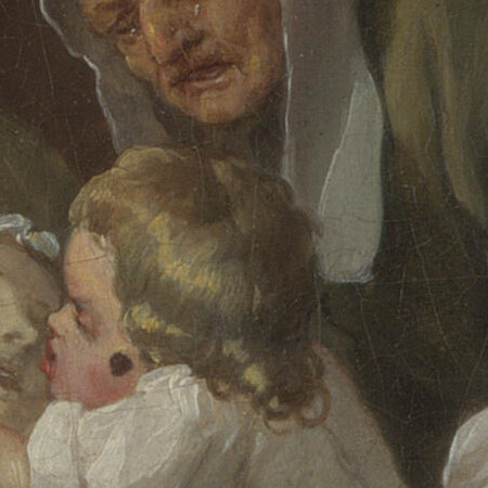 The child's face in profile with a dark spot on the cheek
